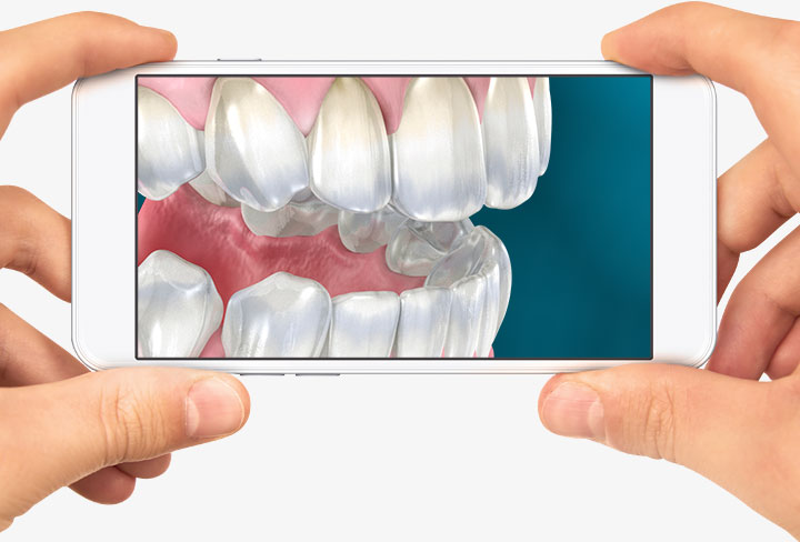 patient-education-bookmark-teeth-iphone.jpg