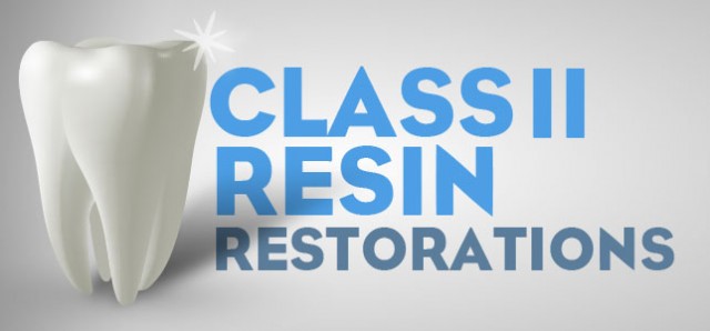 Class II Resin Restorations: Quick Tips to Help Manage the “Step Child” of  Direct Restorations - Spear Education