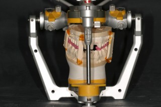 Steps in Cross-Mounting a Case Mounting the cast of the maxillary preparations to the mandibular preparation cast 320x213 1