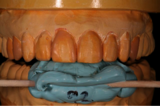 DG030813 Ratcliff Fig 2