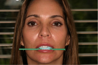 DG030813 Ratcliff Fig 1