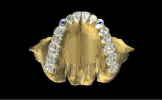 Is Group Function Really Bad? GroupFunction1 320x197 1