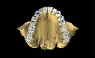 Is Group Function Really Bad? GroupFunction2 320x197 1