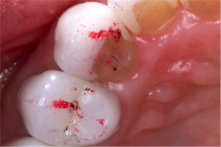 Is Group Function Really Bad? GroupFunction3 320x213 1