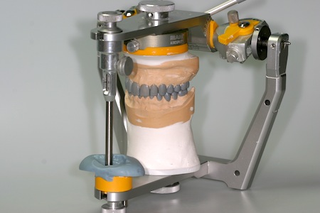 When To Use a Custom Incisal Guide Table? Custom Guide 1