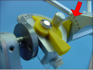 How To Take a Protrusive Bite Record Protrusive3 317x240 1