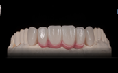 Darin Dichter Understanding Lab Putty Featured Image