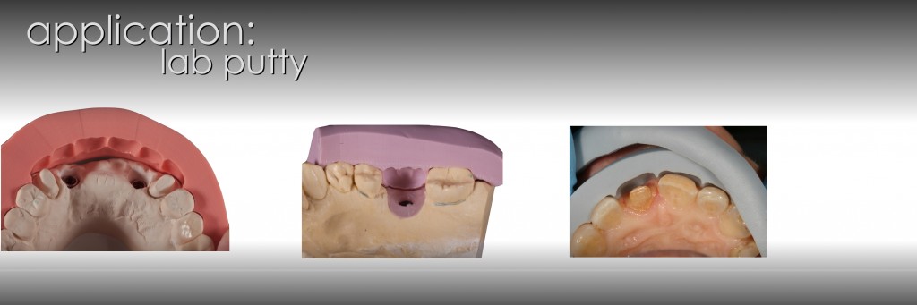 Darin Dichter Understanding Lab Putty Figure 1