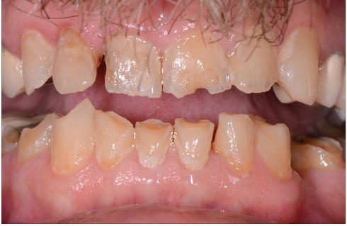 These 4 Questions Can Save Your Patient’s Life image 1