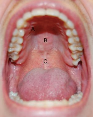 These 4 Questions Can Save Your Patient’s Life image