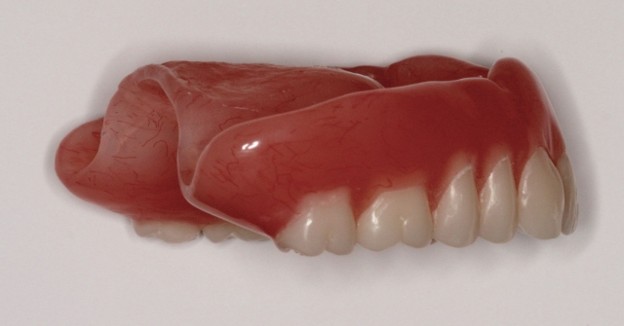 efrver Complete upper denture with reduced palatal coverage designed to improve comfort and help patients manage how to get rid of gag reflex sensitivity associated with removable prostheses.
