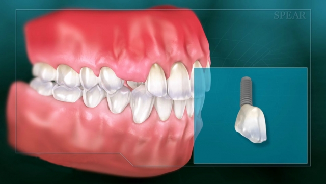 Understanding the Informed Consent Process for Dentists Kevin Huff informed consent Figure 3