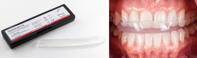 Replacing Triad Provisional Material provisional materials figure 4