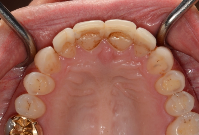 Marinescu technology doesnt always make 03