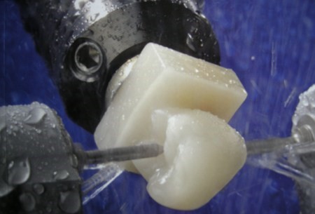 Milled vs. Waxed-And-Pressed Restorations: Which Is Better? milled fig 2