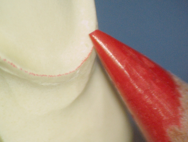 Milled vs. Waxed-And-Pressed Restorations: Which Is Better?