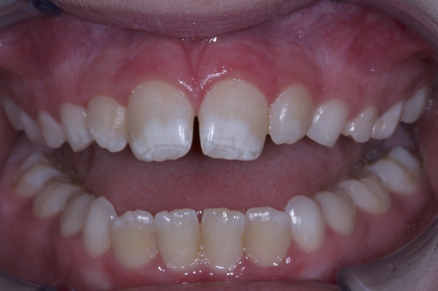 Orthodontics: A Link to Health and Wellness? Jeff Rouse Orthodontics A Link to Health and Wellness fig1