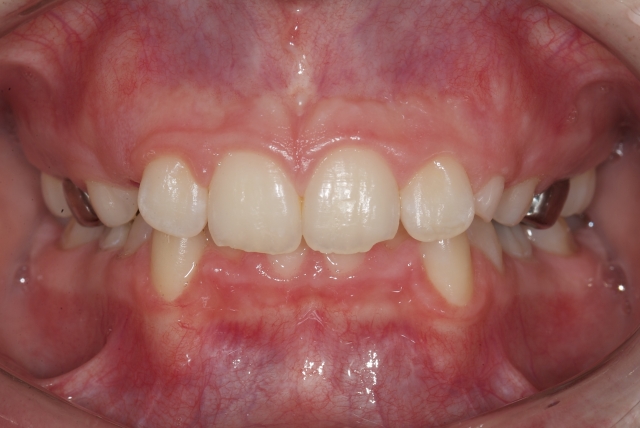 Orthodontics: A Link to Health and Wellness? Jeff Rouse Orthodontics A Link to Health and Wellness fig2