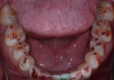 Punishment for ‘Needing’ a MAD: Condemned to Suboptimal Treatment? Fig 9