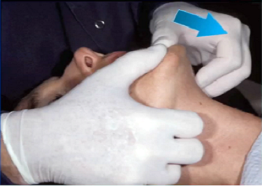 Demystifying Manipulation for Obtaining Centric Relation image