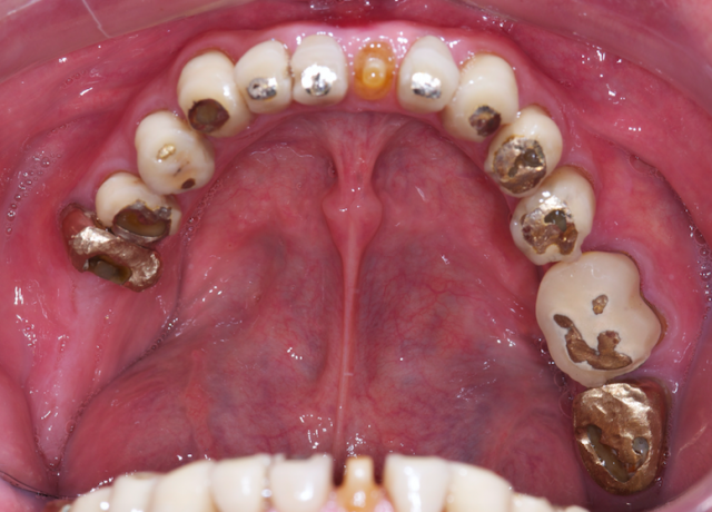 A Return Worth Investing In for Your Dental Career Rouse return worth investing 01