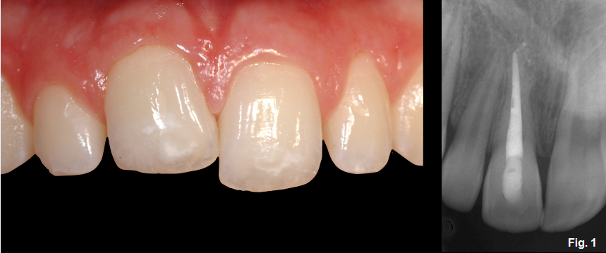 Greggory Kinzer Ankylosis Part III fig1