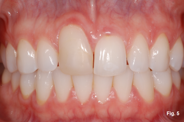 Greggory Kinzer Ankylosis Part III fig5