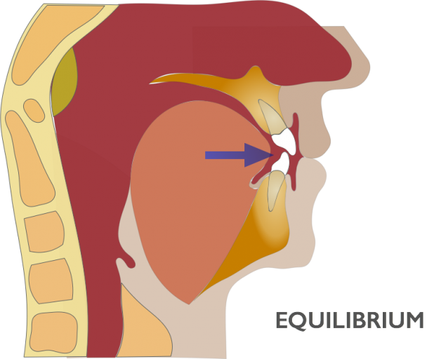 The Tongue’s Role in Pediatric Sleep Disorders and Skeletal Growth and Development image 2