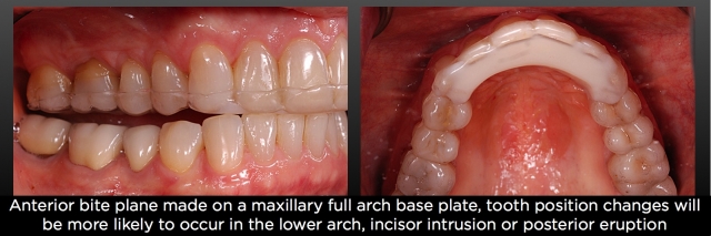 The Dahl Concept image 14