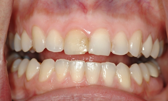 Integrating Nutrition and Wellness Into Your Dental Practice, Part 1 image 2