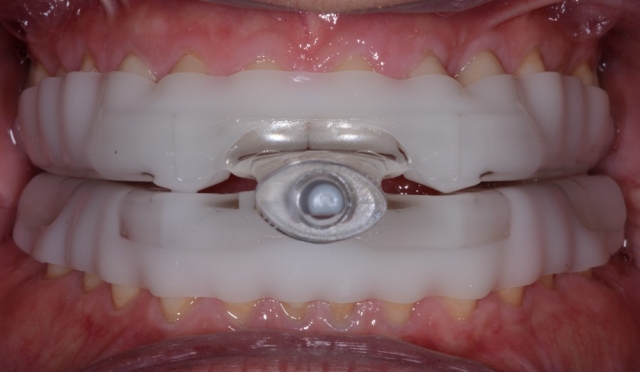 Integrating Nutrition and Wellness Into Your Dental Practice, Part 1 image 4