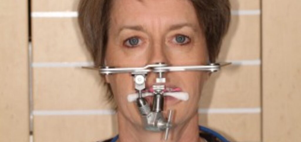 Why a Facebow Is Essential for Restorative Success Frontal view of a facebow frame aligned across a patient's face, with the horizontal crossbar and bite fork engaged for cast orientation