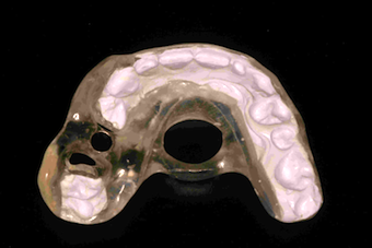 Using Implant Surgical Guides image 1