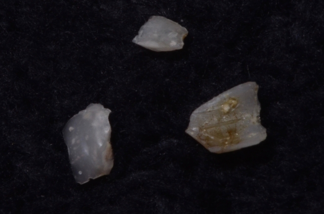 Radiographs and Cement: You Can’t Handle the Truth! image 10