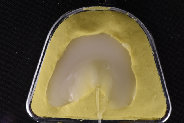 Steps for Denture Duplication — A Visual Essay image 10