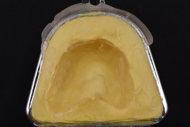 Steps for Denture Duplication — A Visual Essay image 12