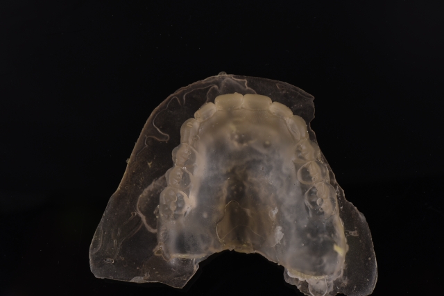 Steps for Denture Duplication — A Visual Essay image 13