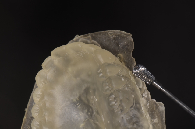 Steps for Denture Duplication — A Visual Essay image 14