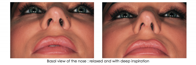 Recommended Photography Series image 16