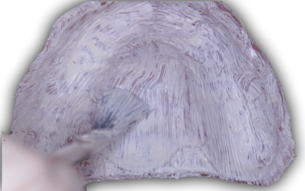 3 Key Clinical Steps for Successful Denture Insertion image 17