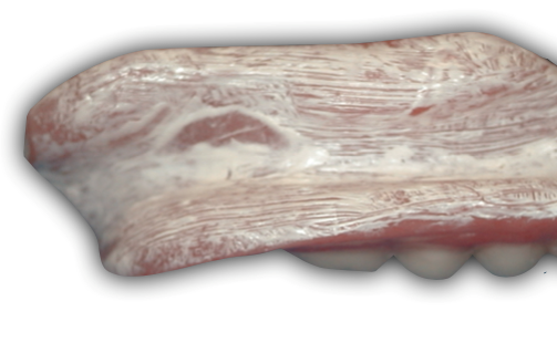 3 Key Clinical Steps for Successful Denture Insertion image 18