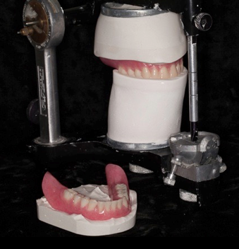 3 Key Clinical Steps for Successful Denture Insertion image 22
