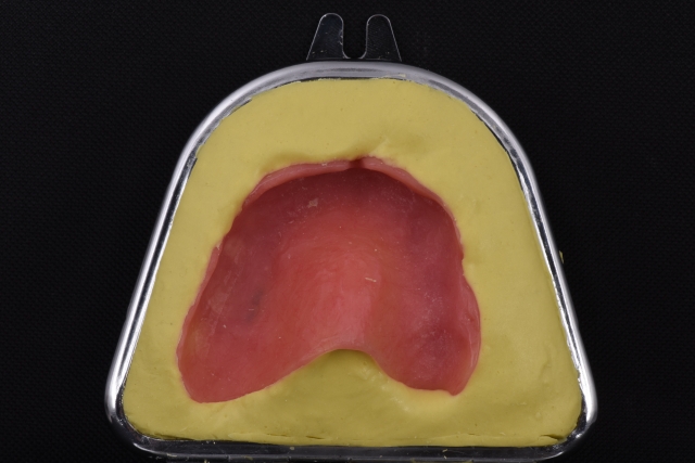 Steps for Denture Duplication — A Visual Essay image 5