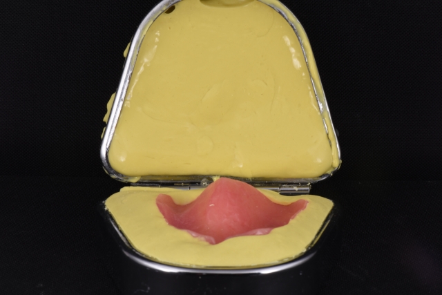Steps for Denture Duplication — A Visual Essay image 6