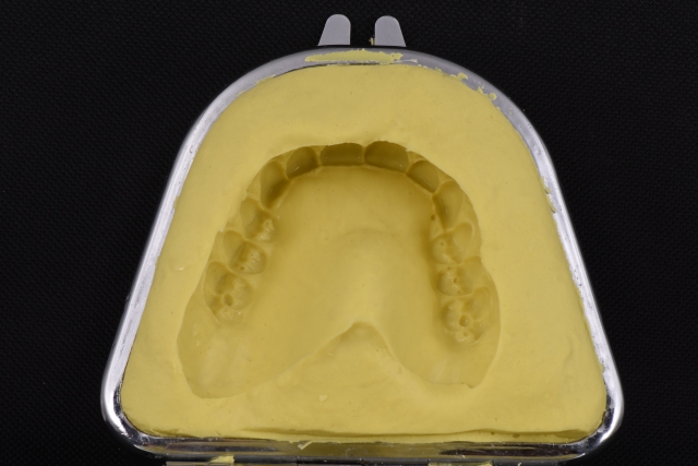 Steps for Denture Duplication — A Visual Essay image 8