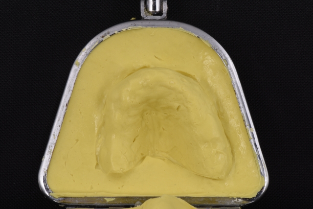 Steps for Denture Duplication — A Visual Essay image 9