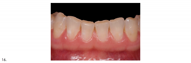 Recommended Photography Series image 9