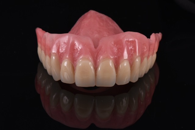 Steps for Denture Duplication — A Visual Essay image