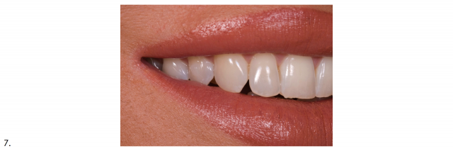 Recommended Photography Series image