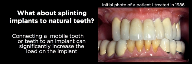 Connecting Teeth and Implants: Yes, No, Maybe? image 5